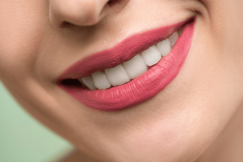 Achieve a Balanced and Beautiful Smile: Gummy Smile Solutions at Dr. Aburas Dental Center