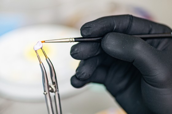 Enhance Your Smile with Zircon Crowns - Dr. Aburas Dental