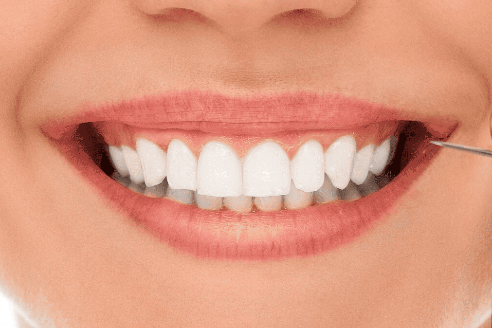 Dr Aburas Denatal Clinic #The Healthy Bright Smile