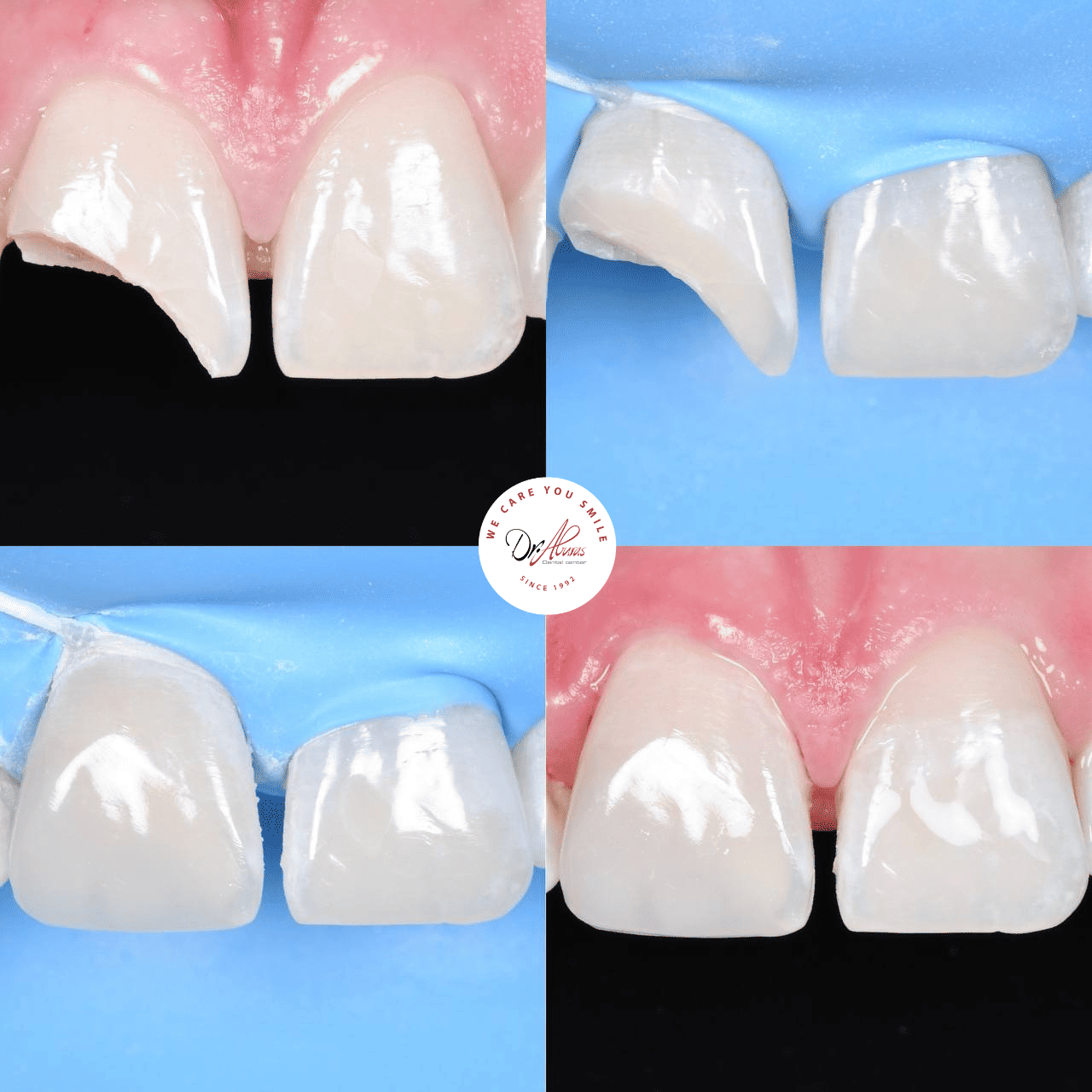 before and after image 1