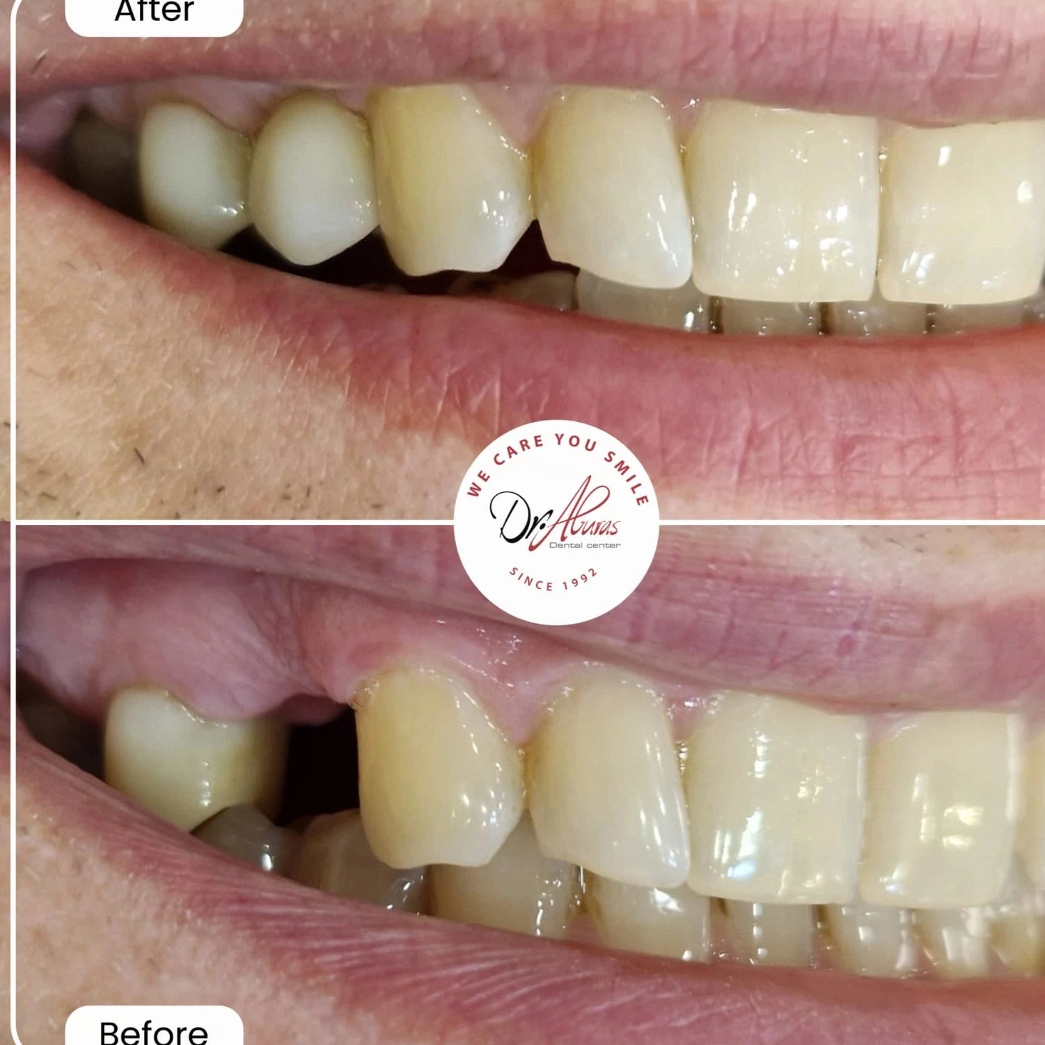 Before-and-After-Image